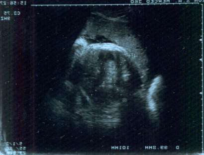 Su primera foto